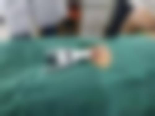 劉昕和医生在哪家医院怎么预约?