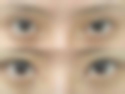 八、长沙妍阡整形医院真实的顾客评价如下: