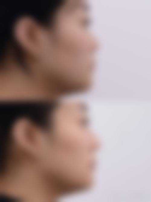 五、日本浅见(アサミ)整形美容外科医院怎么预约: