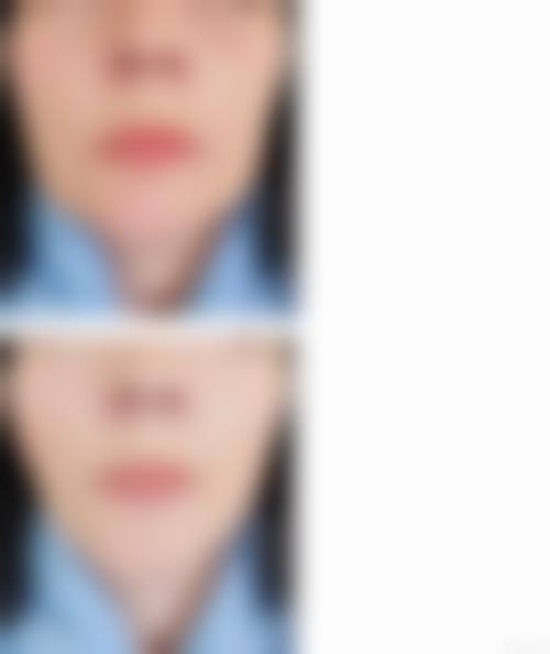 六、济南奥若拉医疗美容诊所怎么预约: