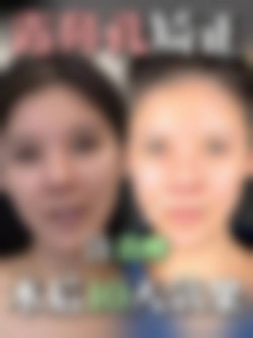 二、利辛县人民医院(整形美容外科)正规吗?来看看医院资质: