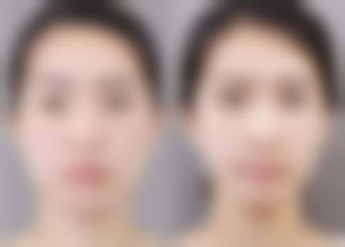 五、东莞虎门环球美天悦美整形医院怎么预约: