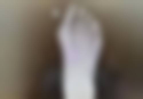 多种治疗方法齐上阵,淡化面部疤痕有妙招