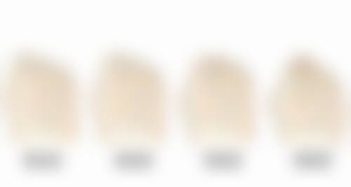上眼皮厚选双眼皮手术:针对脂肪的妙招——眼部吸脂手术