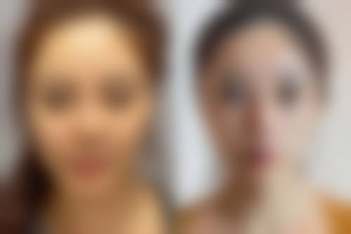 七、泉州弗丽嘉(原亿露美)医疗美容门诊部真实的顾客评价如下: