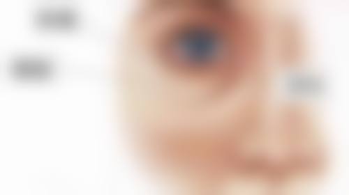 上眼皮厚该选啥双眼皮？全切、Park等术式改善臃肿松弛，效果持久恢复快 