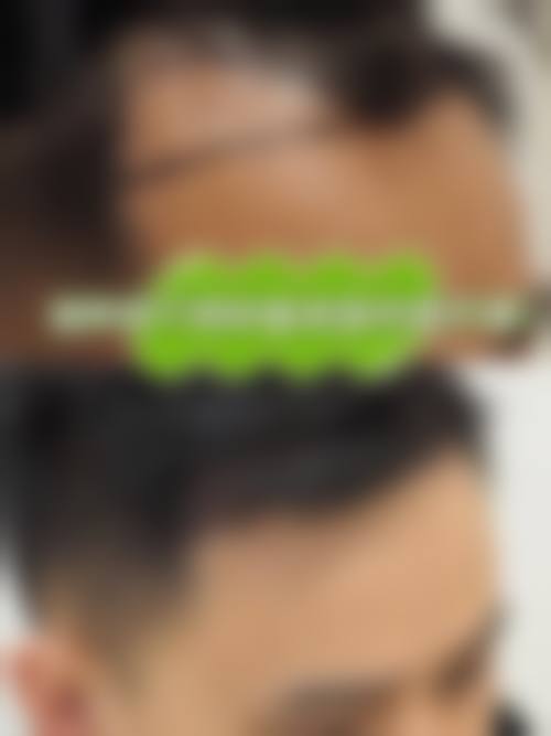 朱世伟医生怎么样可靠吗?