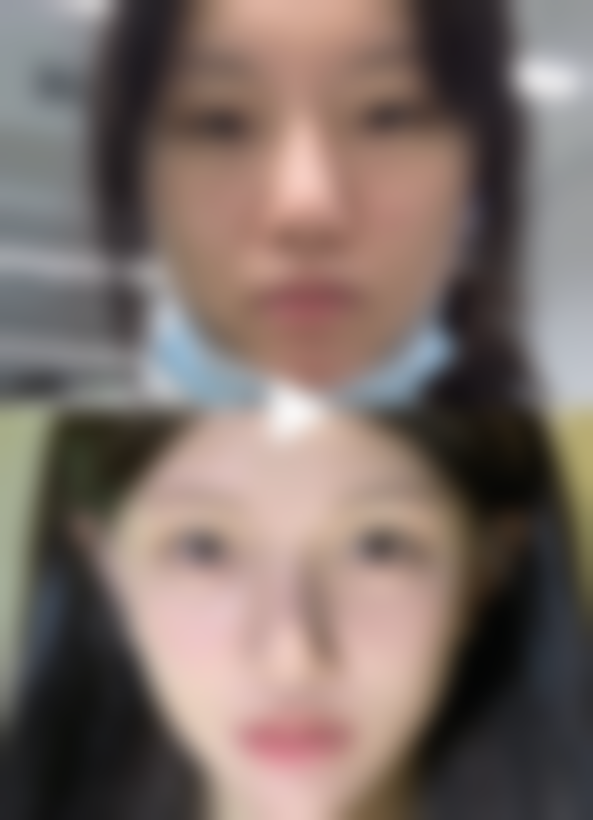 七、北京荟颜美莲臣医疗美容诊所真实的顾客评价如下: