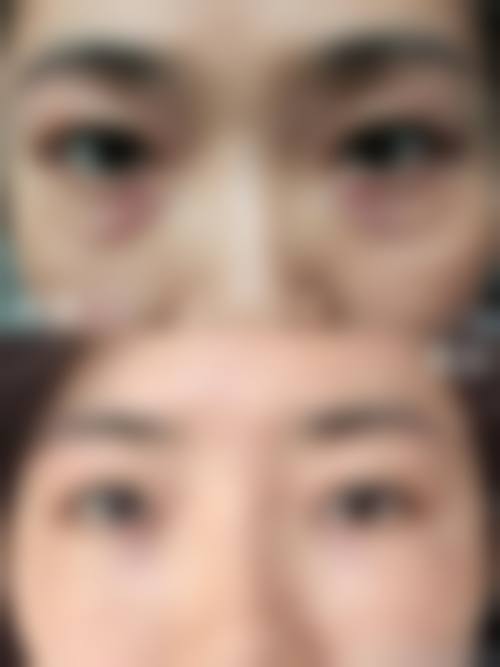 八、杭州柏思颜整形医院真实的顾客评价如下: