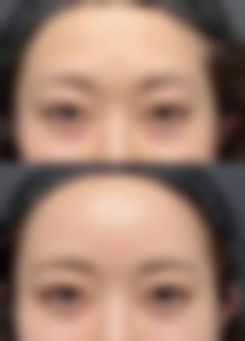 四、广州弘基医疗美容实例