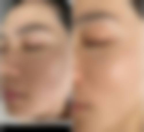 五、旺苍县人民医院整形美容科实例