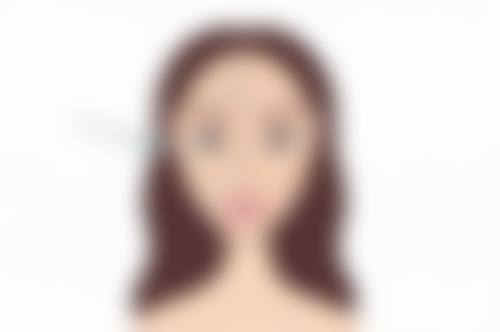 去眼袋术后护理与风险预防要点