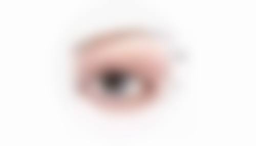 去眼袋后特殊后遗症及成因