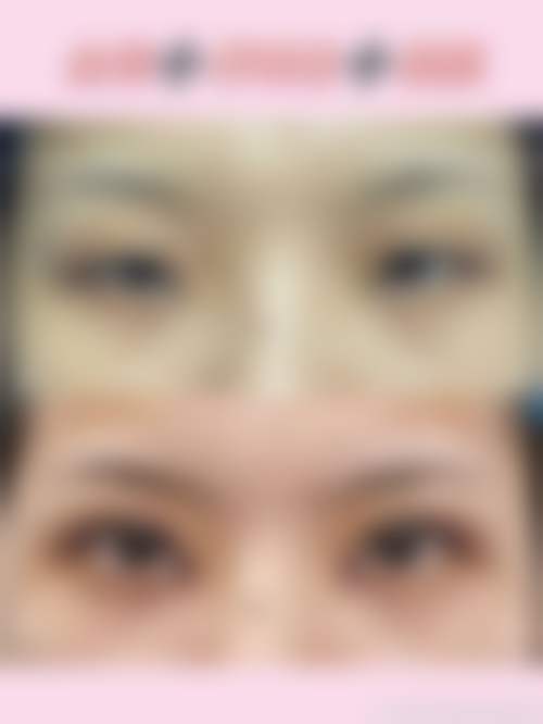 郭栓全医生项目价格表参考