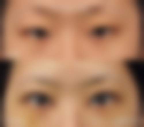 郭栓全