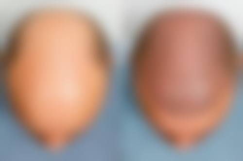 四、重庆新生植发医院基本信息: