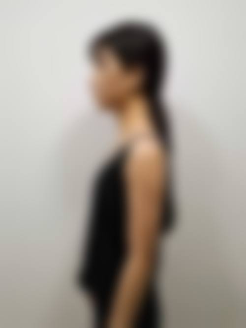八、南昌美之术医疗美容诊所真实的顾客评价如下: