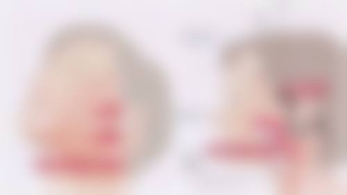 如何效率高去除痘坑疤痕?补充说明特别重要