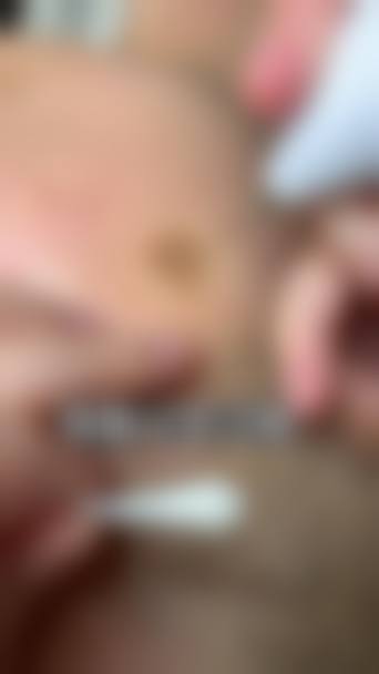 八、上海复大医院整形(皮肤科)真实的顾客评价如下: