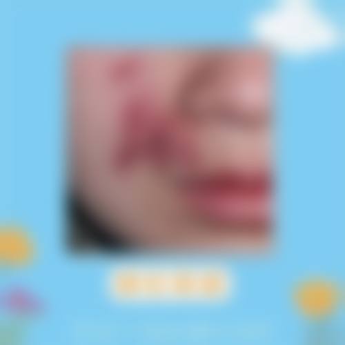 六、上海复大医院整形(皮肤科)怎么预约: