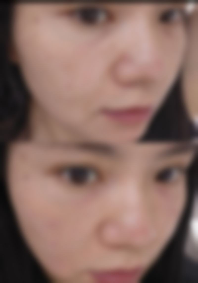 臀部吸脂减肥疼感几何?术中麻醉来帮忙