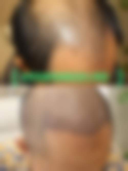 扬州雨辰医疗美容门诊部怎么样