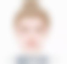 被挠伤的疤痕去除有啥优势?多种手段成效佳