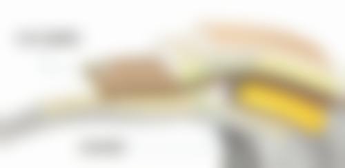 筋膜恒久无痕双眼皮:适合人群大揭秘