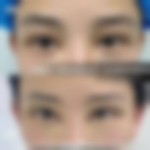 七、西安赫比整形医疗美容门诊部价格表：（仅供参考）