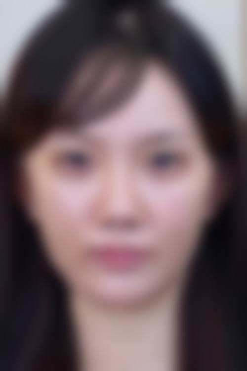 六、韩国Bitchaewoon皮肤科怎么预约: