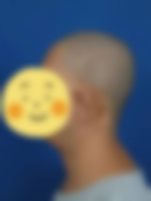 五、秦皇岛和生医疗美容实例