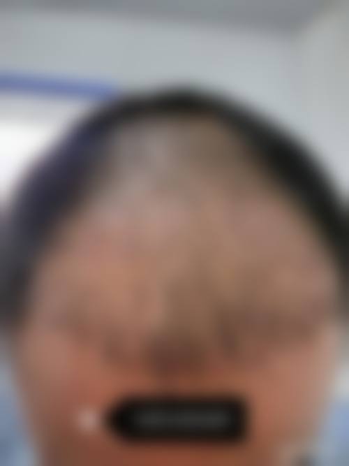 卢林凤医生在哪家医院怎么预约?