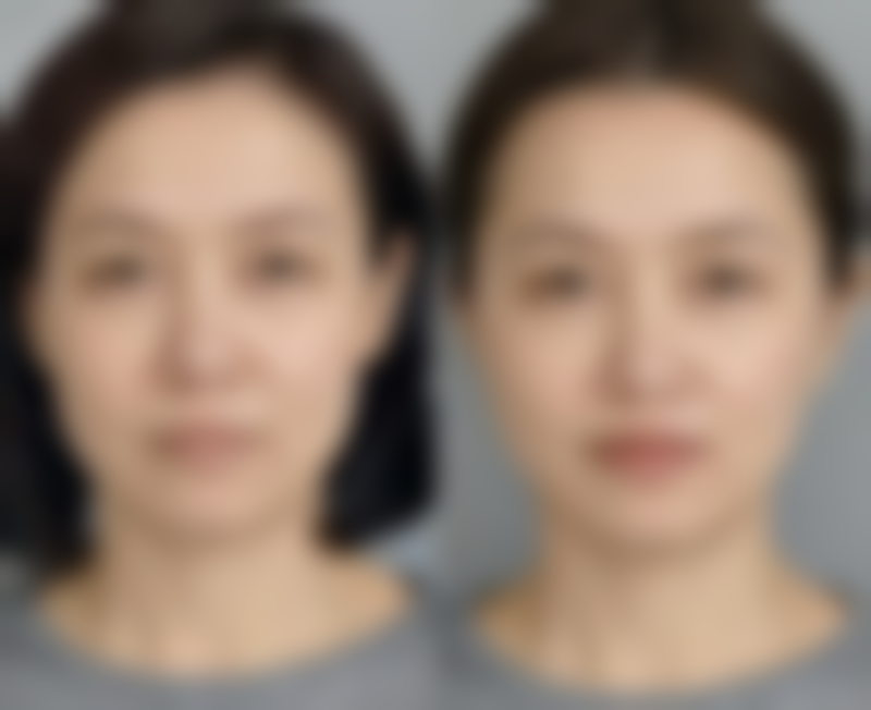 七、秦皇岛和生医疗美容价格表:(仅供参考)