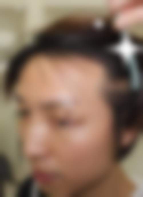 五、镇江新生植发医院怎么预约:
