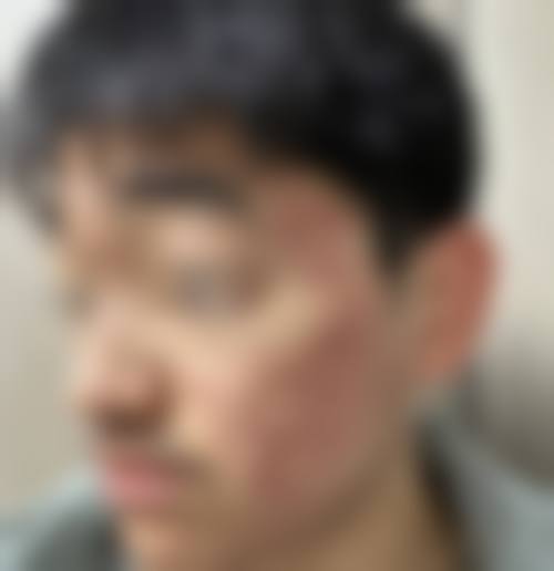 游丹愉医生在哪家医院怎么预约?